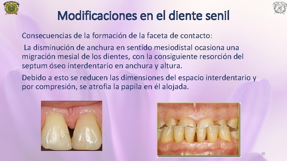 Modificaciones en el diente senil Consecuencias de la formación de la faceta de contacto: