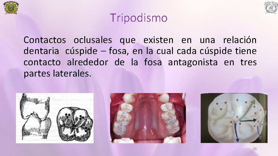 Tripodismo Contactos oclusales que existen en una relación dentaria cúspide – fosa, en la