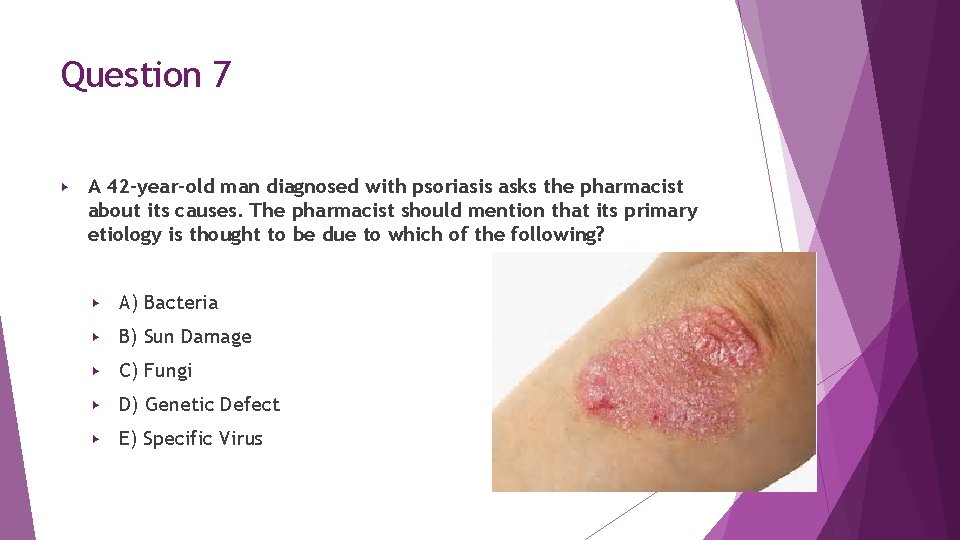 Question 7 ▶ A 42 -year-old man diagnosed with psoriasis asks the pharmacist about Question 7 ▶ A 42 -year-old man diagnosed with psoriasis asks the pharmacist about