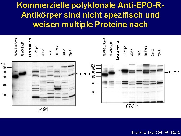 Leerer Vektor Kommerzielle polyklonale Anti-EPO-RAntikörper sind nicht spezifisch und weisen multiple Proteine nach EPOR