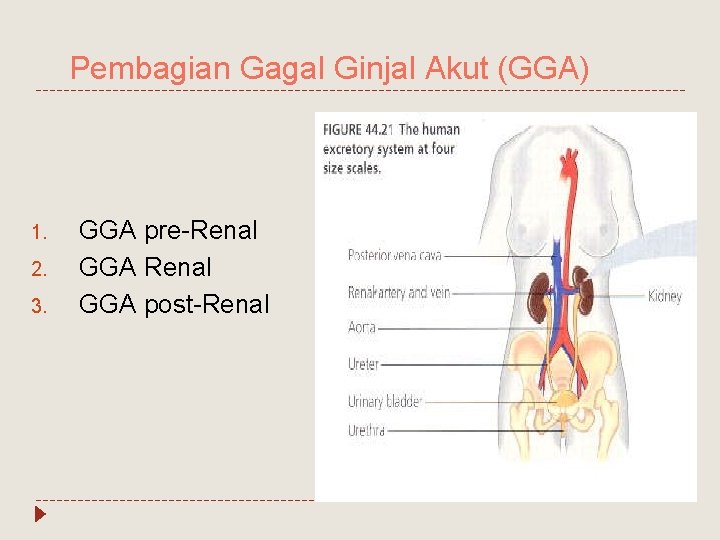 Pembagian Gagal Ginjal Akut (GGA) 1. 2. 3. GGA pre-Renal GGA post-Renal 