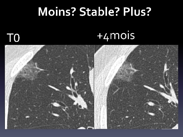 Moins? Stable? Plus? +4 mois T 0 