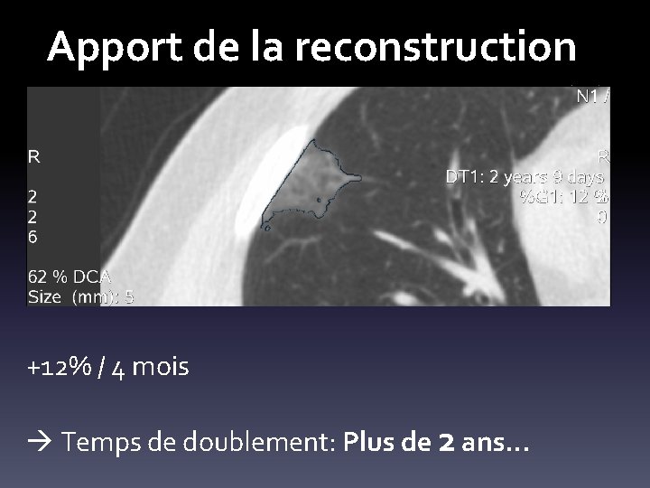 Apport de la reconstruction +12% / 4 mois Temps de doublement: Plus de 2