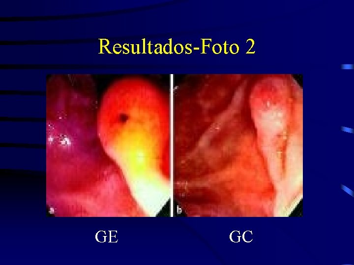 Resultados-Foto 2 GE GC 