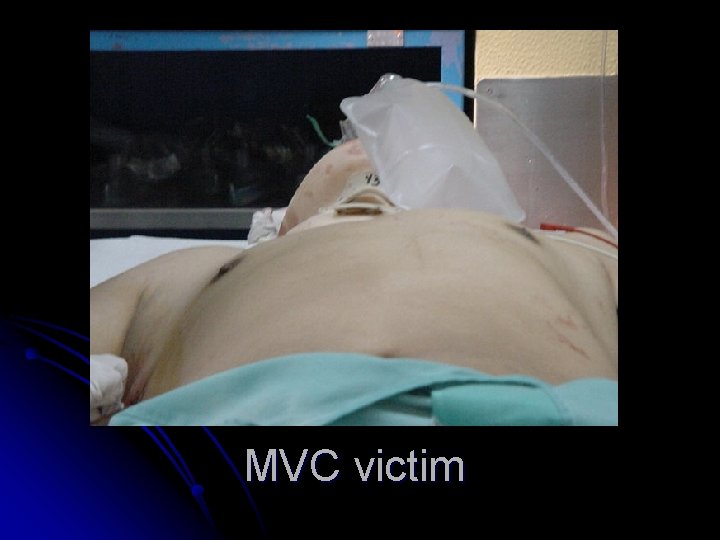 MVC victim 