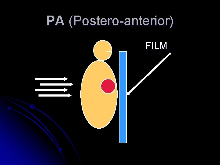 PA (Postero-anterior) FILM 