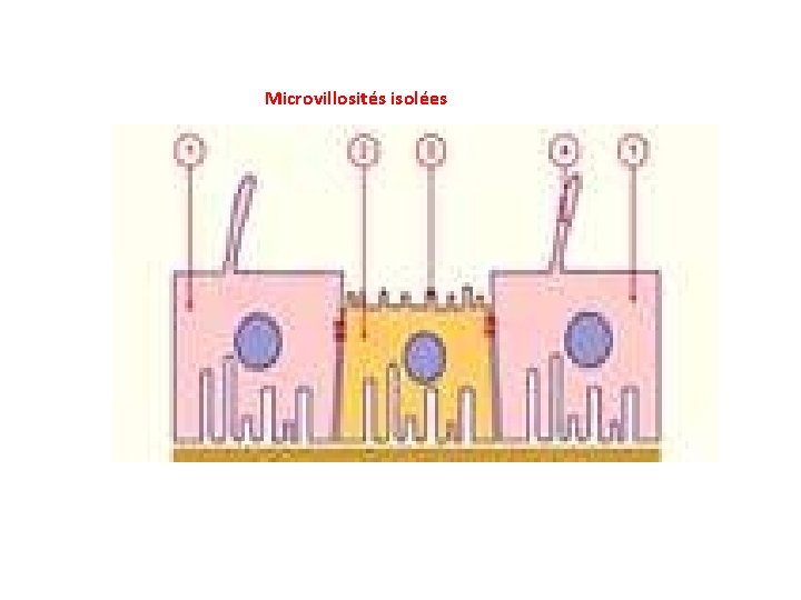 Microvillosités isolées 