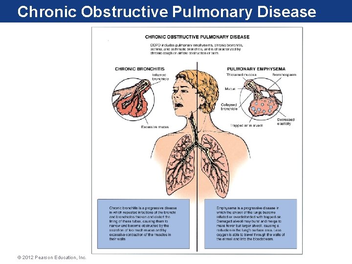 Chronic Obstructive Pulmonary Disease © 2012 Pearson Education, Inc. Chronic Obstructive Pulmonary Disease © 2012 Pearson Education, Inc.