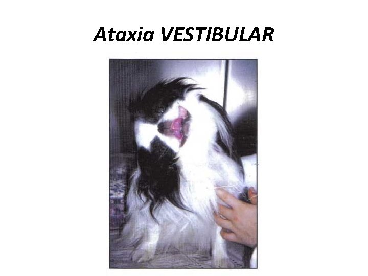 Ataxia VESTIBULAR 