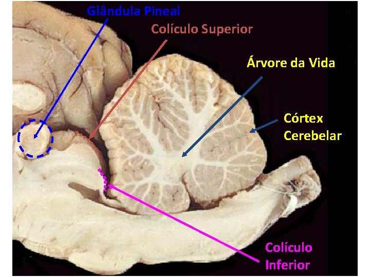 Glândula Pineal Colículo Superior Árvore da Vida Córtex Cerebelar Colículo Inferior 