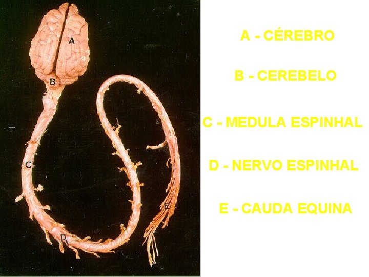 A - CÉREBRO B - CEREBELO C - MEDULA ESPINHAL D - NERVO ESPINHAL