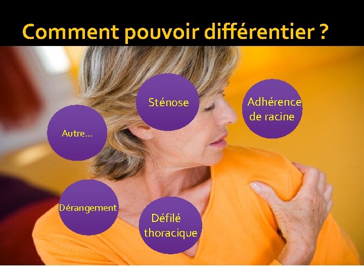 Comment pouvoir différentier ? Sténose Autre… Dérangement Défilé thoracique Adhérence de racine 