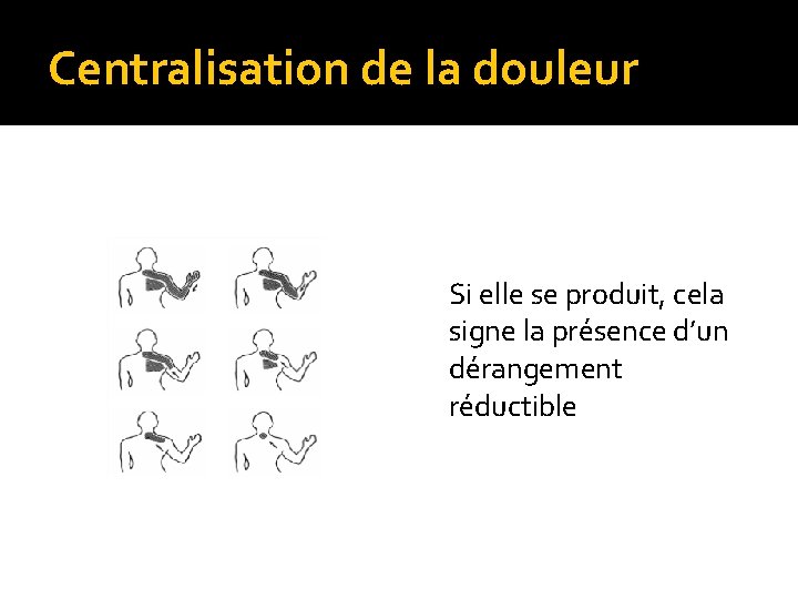 Centralisation de la douleur Si elle se produit, cela signe la présence d’un dérangement