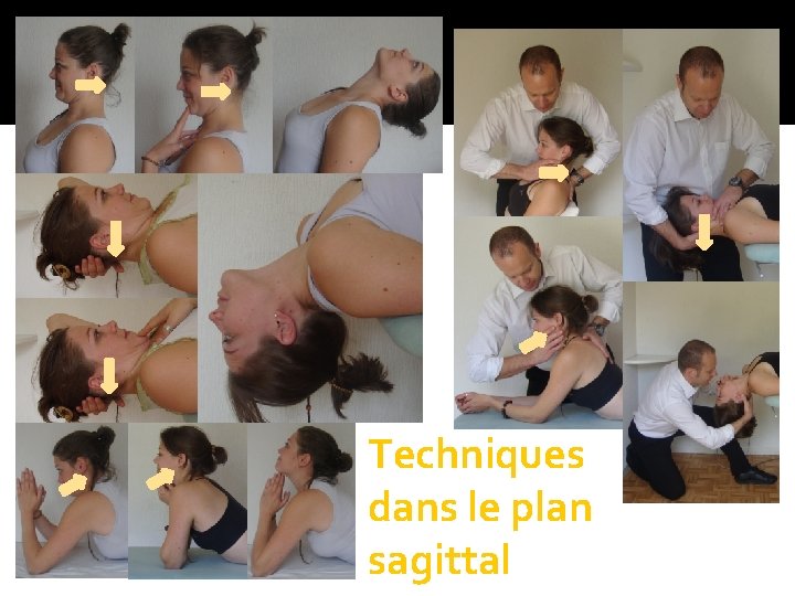 Techniques dans le plan sagittal 