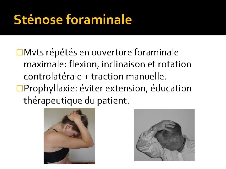 Sténose foraminale �Mvts répétés en ouverture foraminale maximale: flexion, inclinaison et rotation controlatérale +