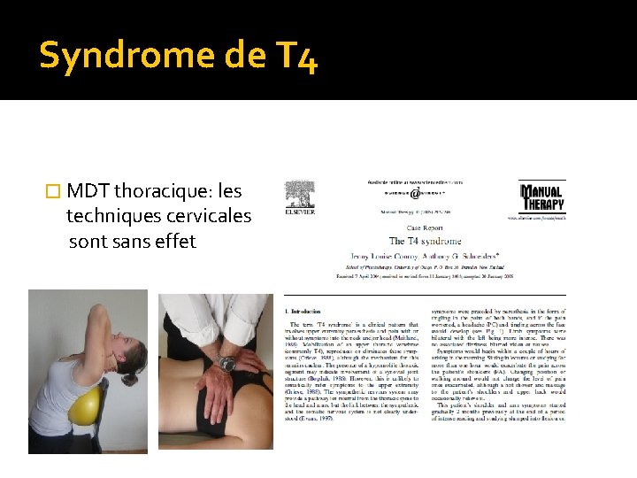 Syndrome de T 4 � MDT thoracique: les techniques cervicales sont sans effet 