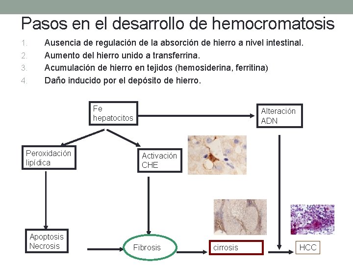 Pasos en el desarrollo de hemocromatosis 1. 2. 3. 4. Ausencia de regulación de