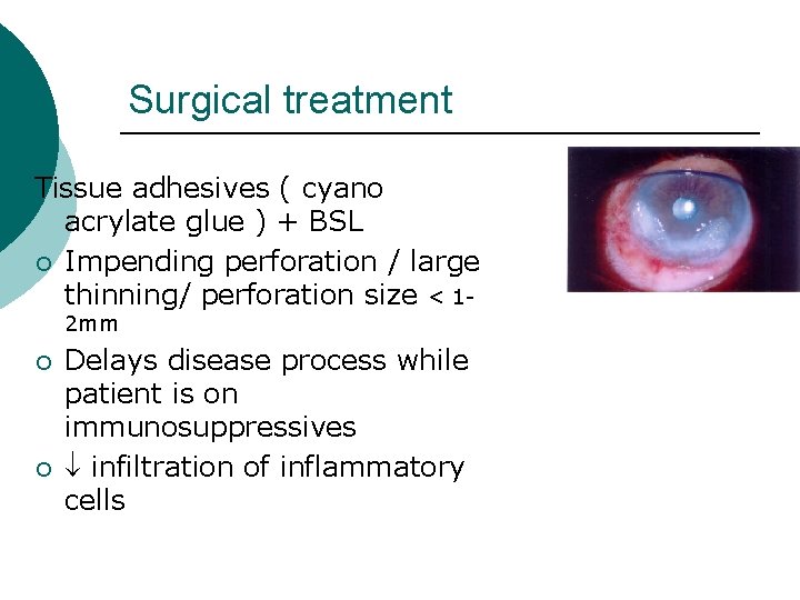 Surgical treatment Tissue adhesives ( cyano acrylate glue ) + BSL ¡ Impending perforation