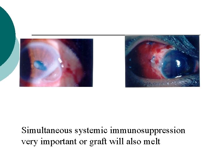 Simultaneous systemic immunosuppression very important or graft will also melt 