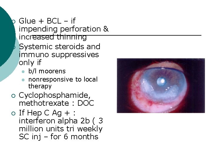 ¡ ¡ Glue + BCL – if impending perforation & increased thinning Systemic steroids