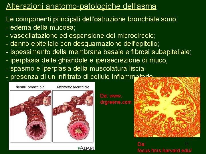 Alterazioni anatomo-patologiche dell'asma Le componenti principali dell'ostruzione bronchiale sono: - edema della mucosa; -