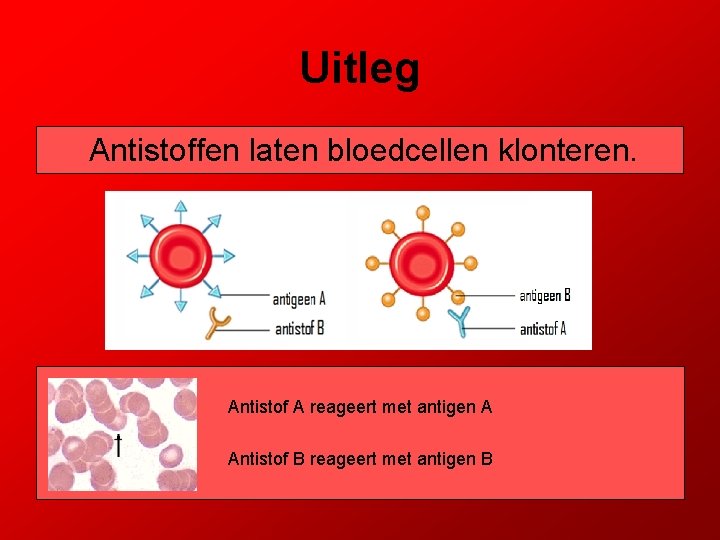 Uitleg Antistoffen laten bloedcellen klonteren. Antistof A reageert met antigen A Antistof B reageert
