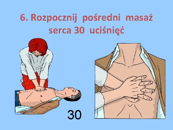 6. Rozpocznij pośredni masaż serca 30 uciśnięć 30 