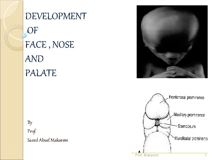 DEVELOPMENT OF FACE , NOSE AND PALATE By Prof. Saeed Abuel Makarem Prof. Makarem