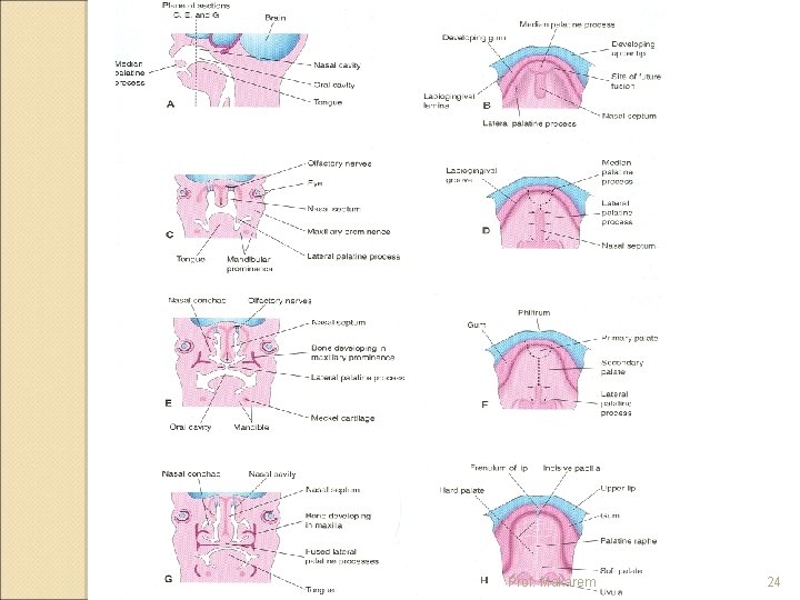 DEVELOPMENT OF FACE NOSE AND PALATE By Prof