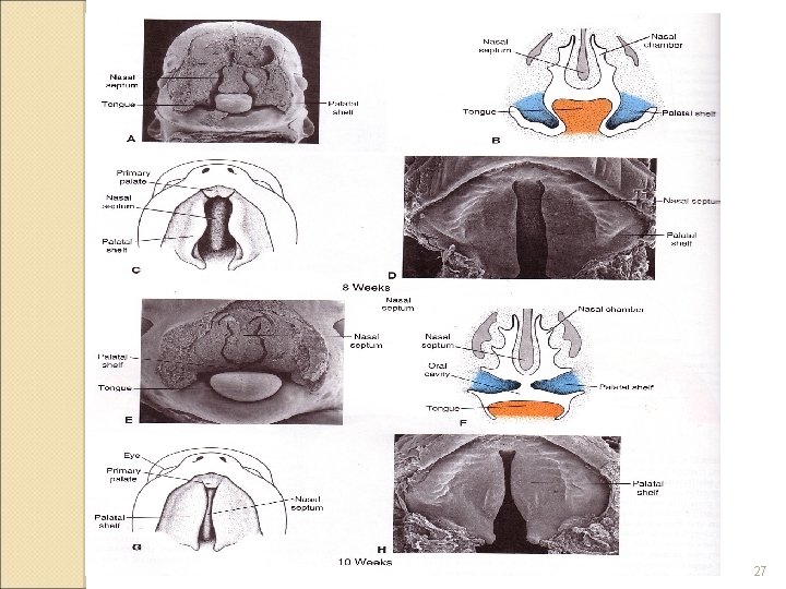 DEVELOPMENT OF FACE NOSE AND PALATE By Prof