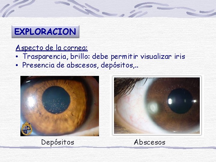EXPLORACION Aspecto de la cornea: • Trasparencia, brillo: debe permitir visualizar iris • Presencia