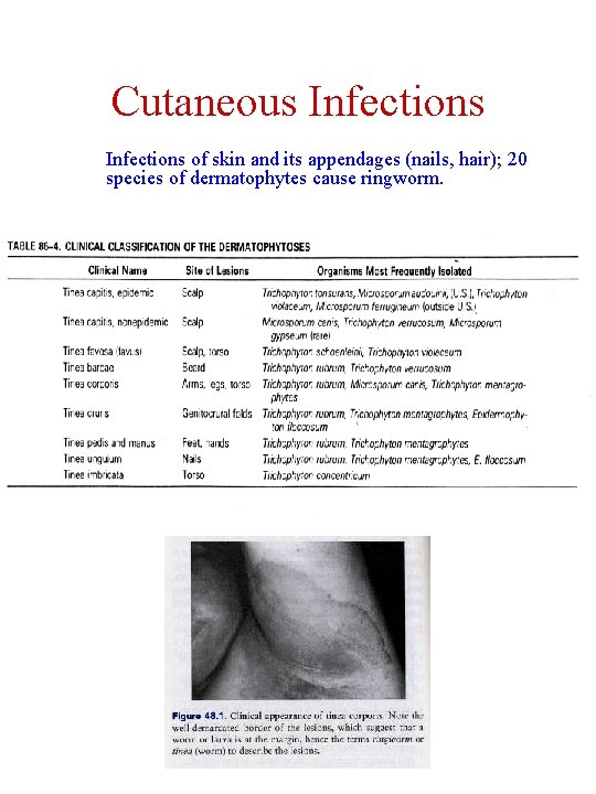 Cutaneous Infections of skin and its appendages (nails, hair); 20 species of dermatophytes cause