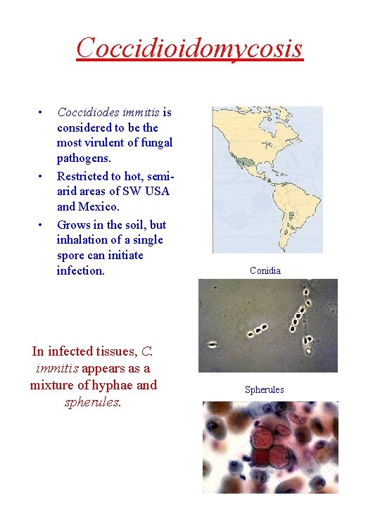 Coccidioidomycosis • • • Coccidiodes immitis is considered to be the most virulent of