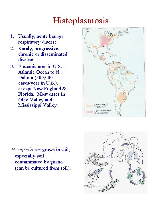 Histoplasmosis 1. Usually, acute benign respiratory disease 2. Rarely, progressive, chronic or disseminated disease