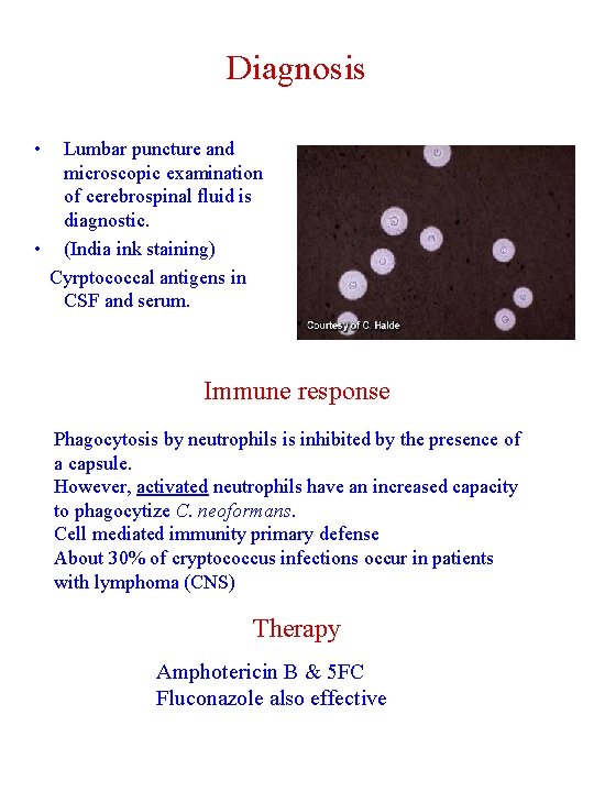 Diagnosis • Lumbar puncture and microscopic examination of cerebrospinal fluid is diagnostic. • (India