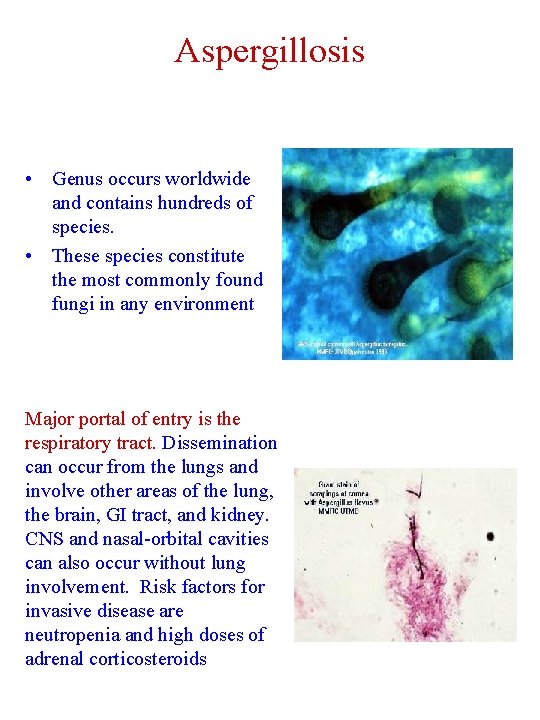 Aspergillosis • Genus occurs worldwide and contains hundreds of species. • These species constitute