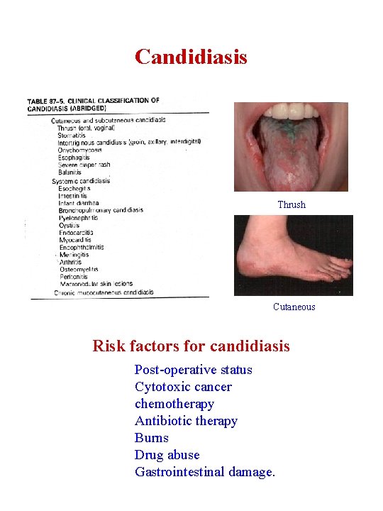 Candidiasis Thrush Cutaneous Risk factors for candidiasis Post-operative status Cytotoxic cancer chemotherapy Antibiotic therapy