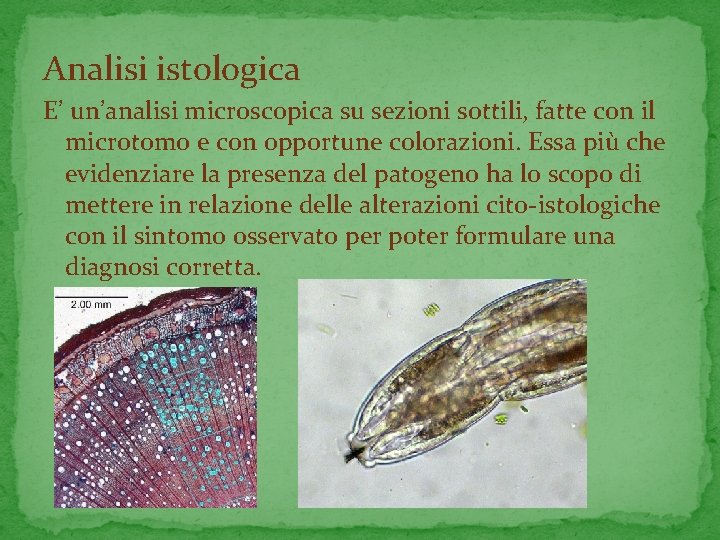 Analisi istologica E’ un’analisi microscopica su sezioni sottili, fatte con il microtomo e con