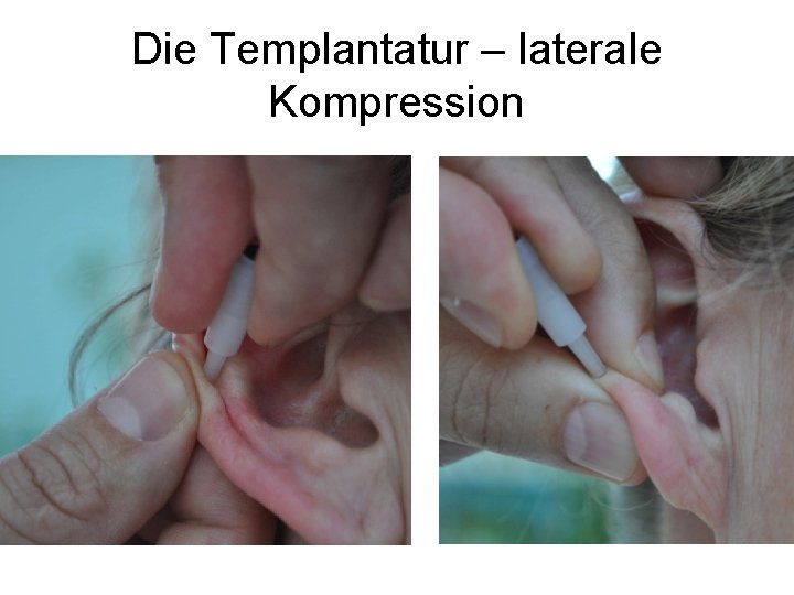Die Templantatur – laterale Kompression 