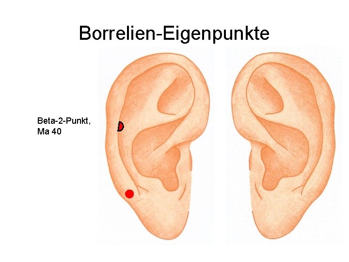 Borrelien-Eigenpunkte Beta-2 -Punkt, Ma 40 