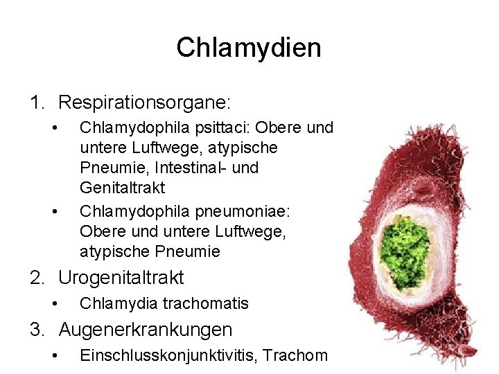 Chlamydien 1. Respirationsorgane: • • Chlamydophila psittaci: Obere und untere Luftwege, atypische Pneumie, Intestinal-