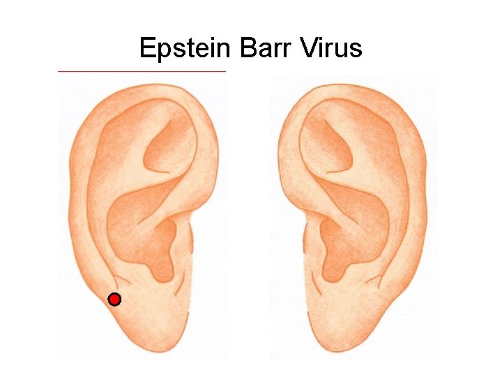 Epstein Barr Virus 