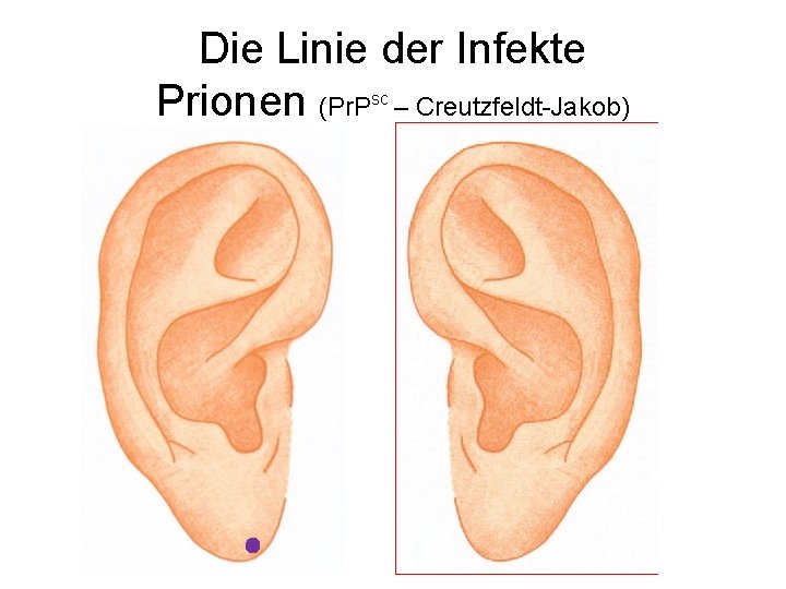 Die Linie der Infekte Prionen (Pr. P – Creutzfeldt-Jakob) sc 