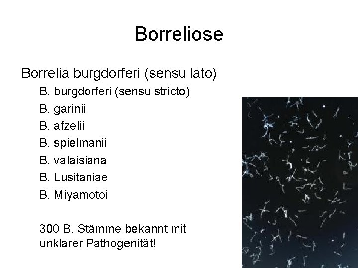 Borreliose Borrelia burgdorferi (sensu lato) B. burgdorferi (sensu stricto) B. garinii B. afzelii B.