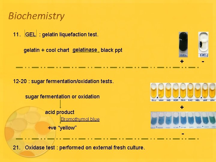 Biochemistry 11. GEL : gelatin liquefaction test. gelatin + cool chart gelatinase black ppt