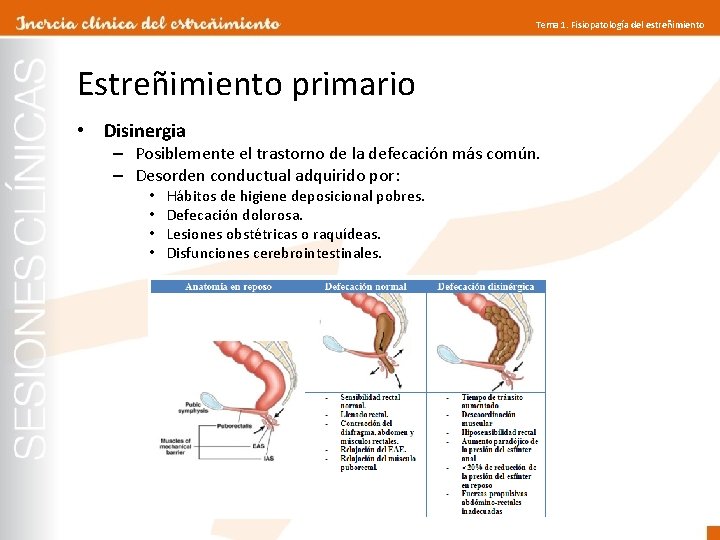 Tema 1. Fisiopatología del estreñimiento Estreñimiento primario • Disinergia – Posiblemente el trastorno de