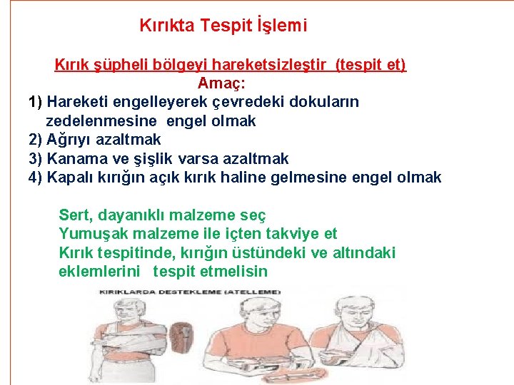 Kırıkta Tespit İşlemi Kırık şüpheli bölgeyi hareketsizleştir (tespit et) Amaç: 1) Hareketi engelleyerek çevredeki