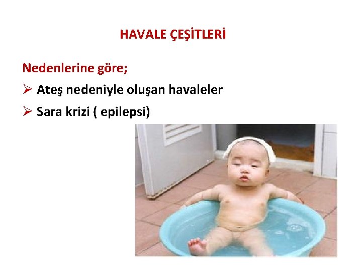 HAVALE ÇEŞİTLERİ Nedenlerine göre; Ø Ateş nedeniyle oluşan havaleler Ø Sara krizi ( epilepsi)