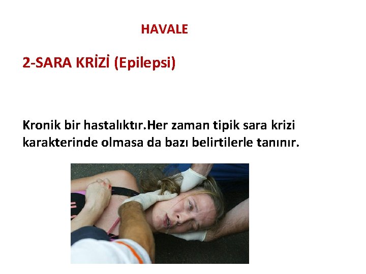 HAVALE 2 -SARA KRİZİ (Epilepsi) Kronik bir hastalıktır. Her zaman tipik sara krizi karakterinde