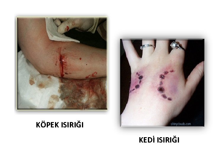 KÖPEK ISIRIĞI KEDİ ISIRIĞI 